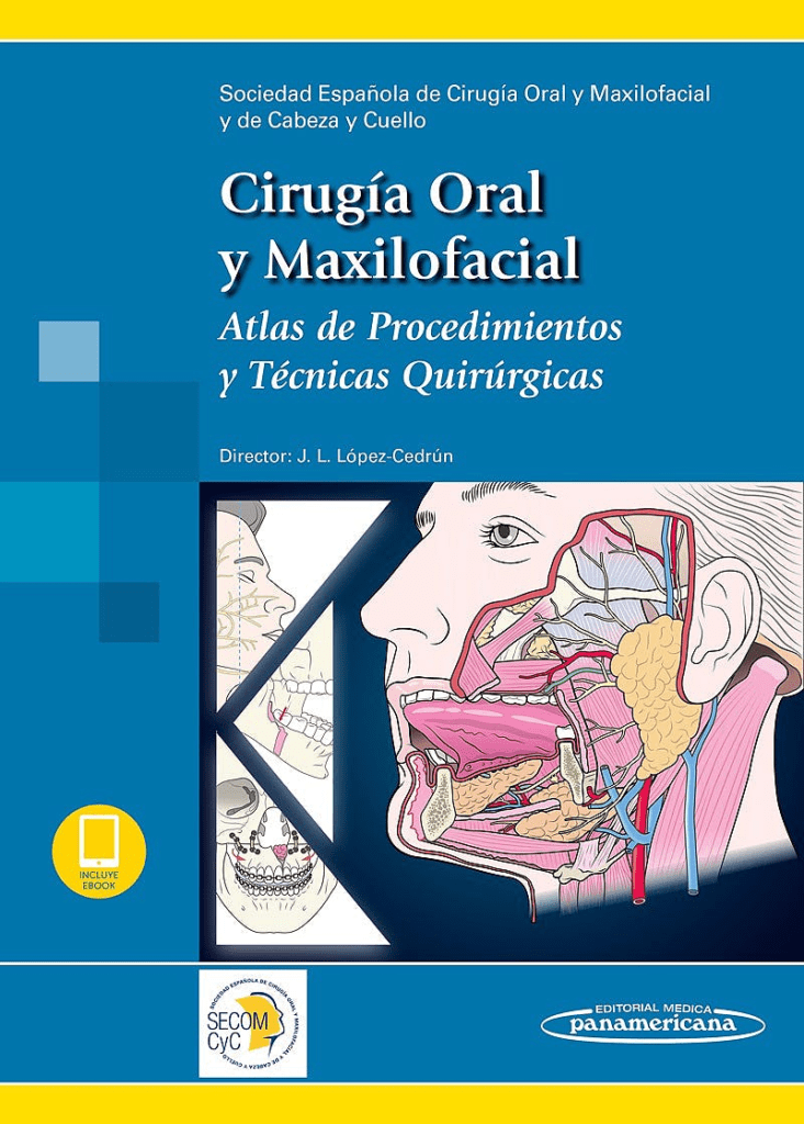 Cirugía Oral y Maxilofacial Atlas de Procedimientos y Técnicas