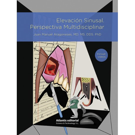 Elevaci N Sinusal Perspectiva Multidisciplinar Divisi N M Dica