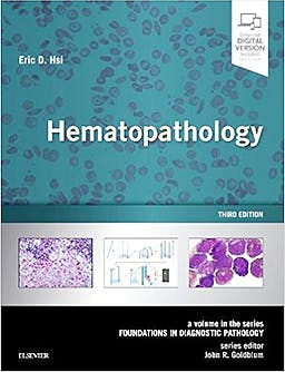 Hematopathology (Foundations In Diagnostic Pathology) (Print And Online ...